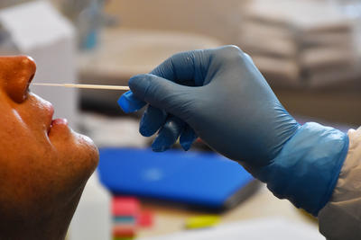 Entnahme eines Nasen-Abstrichs f&uuml;r den Coronavirus-Test.